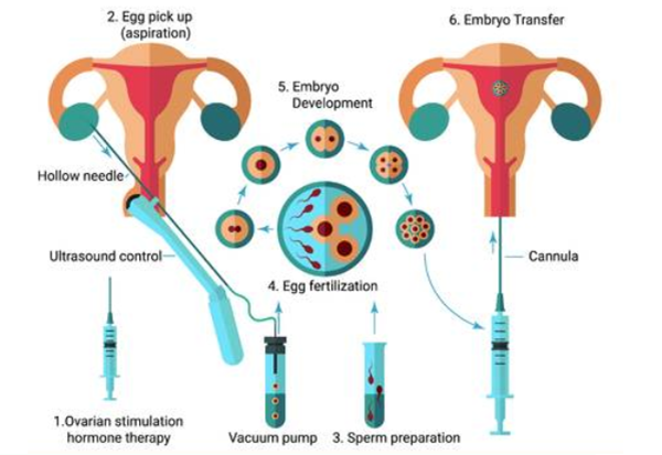 第一次孕检流程