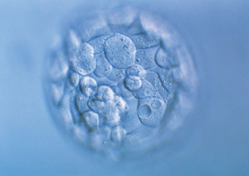 经期长时间出血