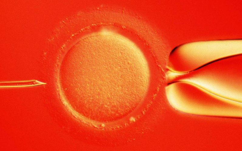 经期血块比较多