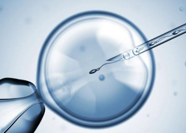 试管婴儿技术